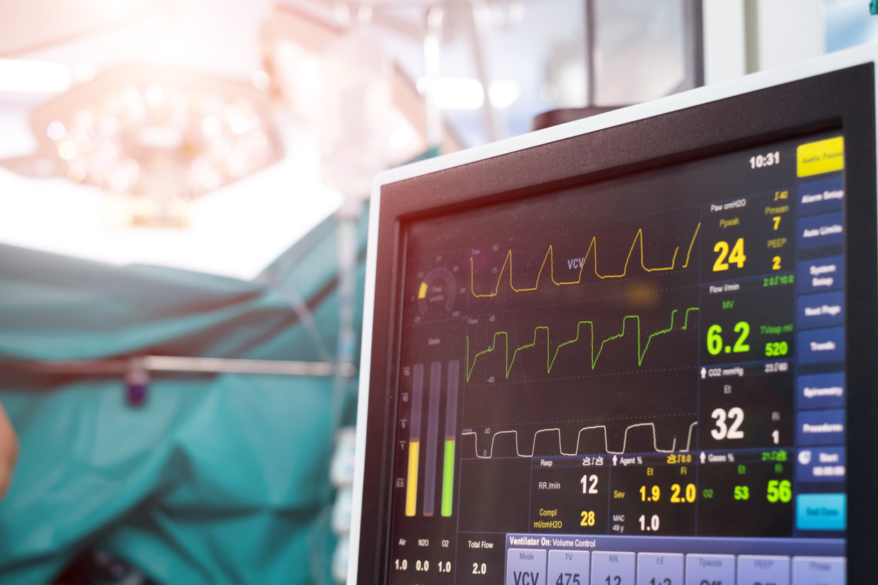 EKG monitor in operating room. Equipment and medical in operating room.